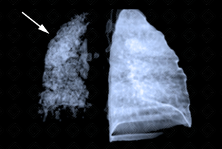 Texto alternativo para a imagem