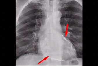 Texto alternativo para a imagem