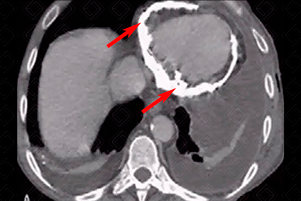 Texto alternativo para a imagem