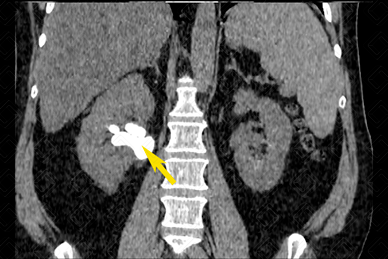 Texto alternativo para a imagem