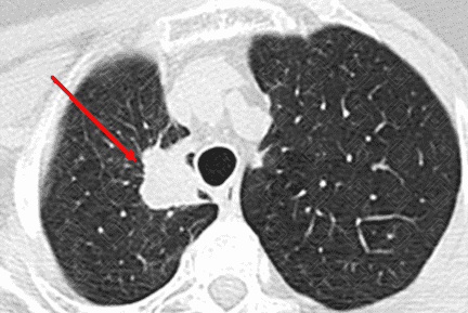 Texto alternativo para a imagem