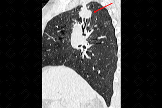 Texto alternativo para a imagem