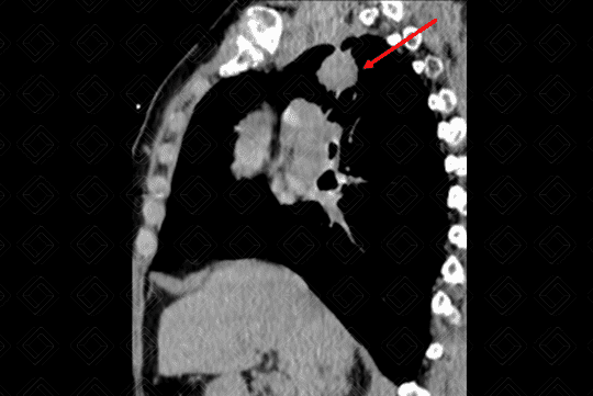 Texto alternativo para a imagem