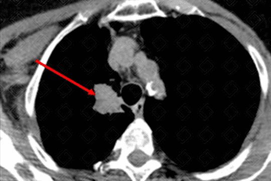 Texto alternativo para a imagem