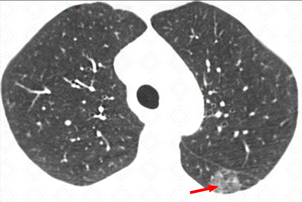 Texto alternativo para a imagem