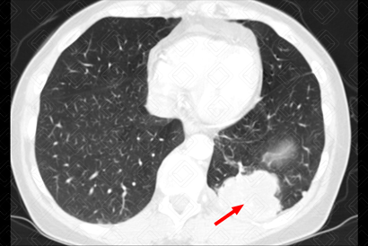 Texto alternativo para a imagem