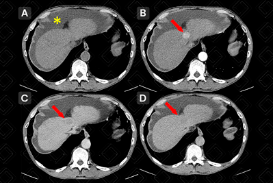 Texto alternativo para a imagem