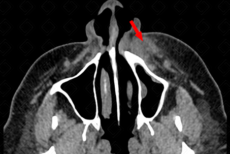 Texto alternativo para a imagem