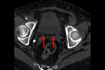 Texto alternativo para a imagem