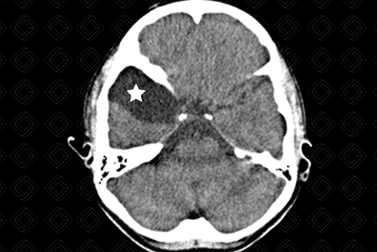 Texto alternativo para a imagem