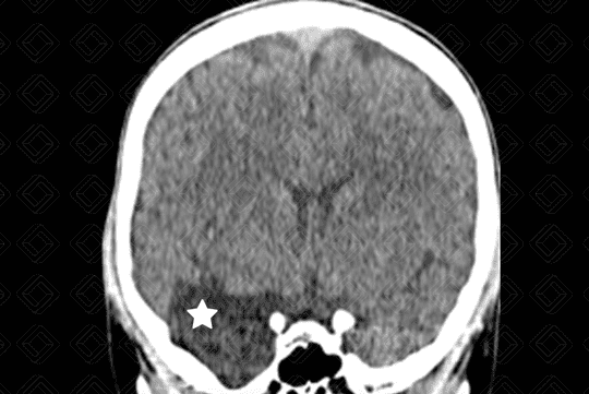 Texto alternativo para a imagem