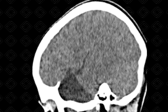 Texto alternativo para a imagem