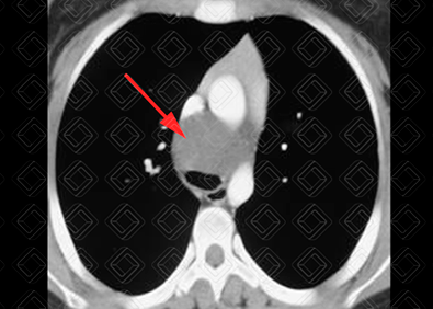 Texto alternativo para a imagem