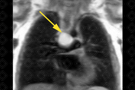 Texto alternativo para a imagem