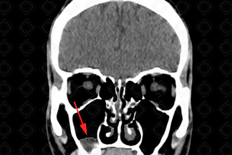Texto alternativo para a imagem