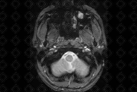 Texto alternativo para a imagem