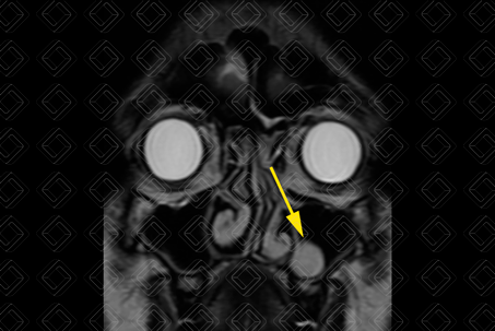 Texto alternativo para a imagem