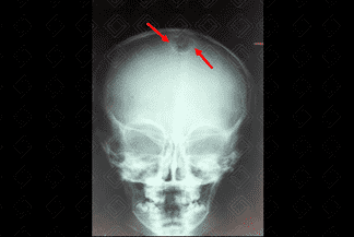 Texto alternativo para a imagem