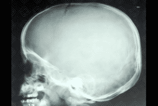 Texto alternativo para a imagem