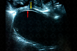 Texto alternativo para a imagem