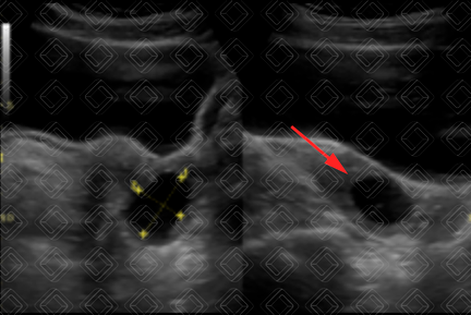 Texto alternativo para a imagem