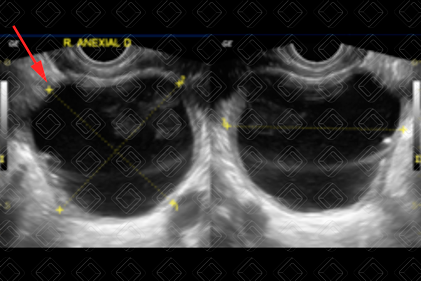 Texto alternativo para a imagem