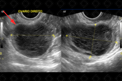 Texto alternativo para a imagem