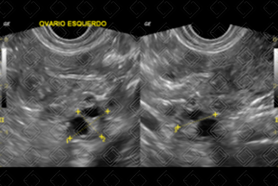 Texto alternativo para a imagem