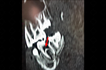 Texto alternativo para a imagem