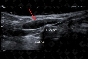 Texto alternativo para a imagem