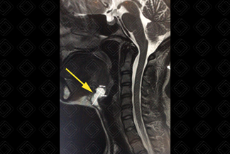 Texto alternativo para a imagem