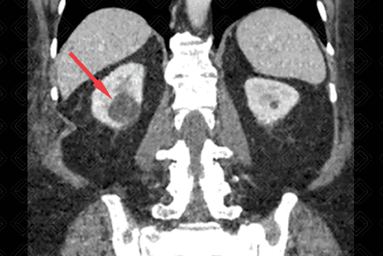 Texto alternativo para a imagem