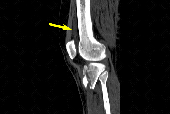 Texto alternativo para a imagem