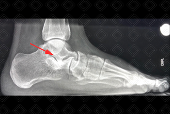 Texto alternativo para a imagem