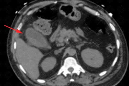 Texto alternativo para a imagem