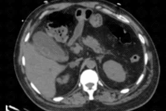 Texto alternativo para a imagem