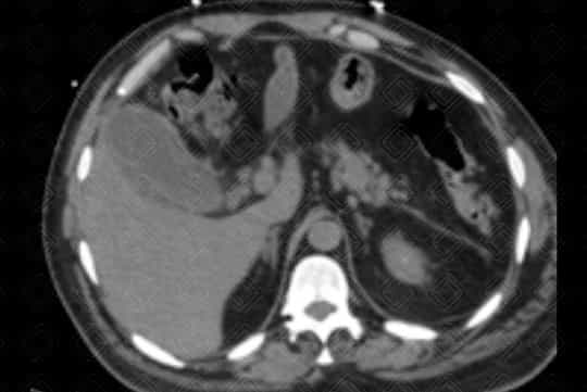 Texto alternativo para a imagem