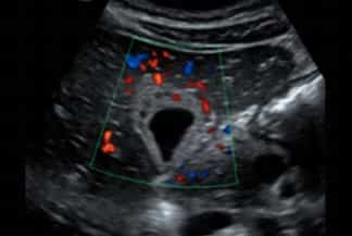 Texto alternativo para a imagem