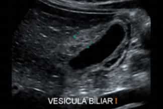 Texto alternativo para a imagem