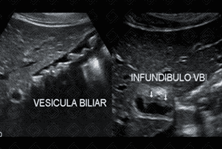 Texto alternativo para a imagem