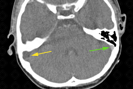 Texto alternativo para a imagem