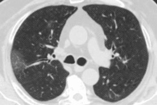 Texto alternativo para a imagem