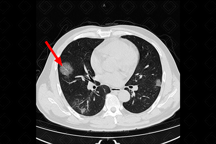 Texto alternativo para a imagem