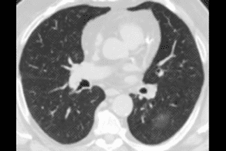 Texto alternativo para a imagem