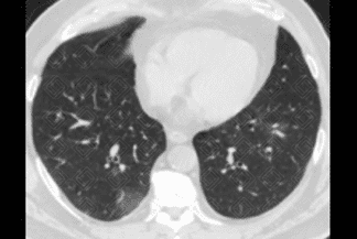 Texto alternativo para a imagem