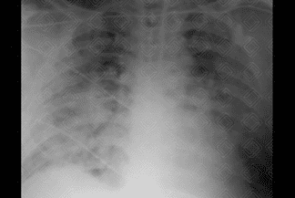 Texto alternativo para a imagem