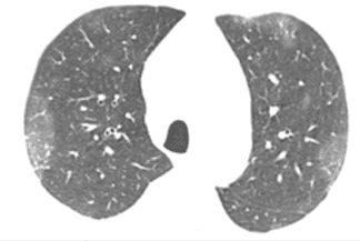 Texto alternativo para a imagem