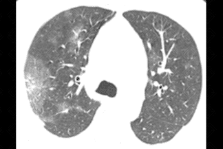 Texto alternativo para a imagem