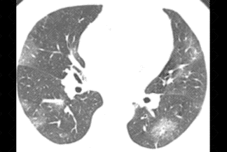 Texto alternativo para a imagem