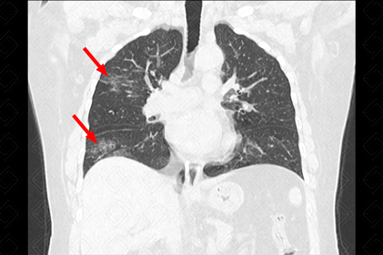 Texto alternativo para a imagem